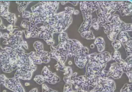 HepG2人肝癌细胞 (STR)