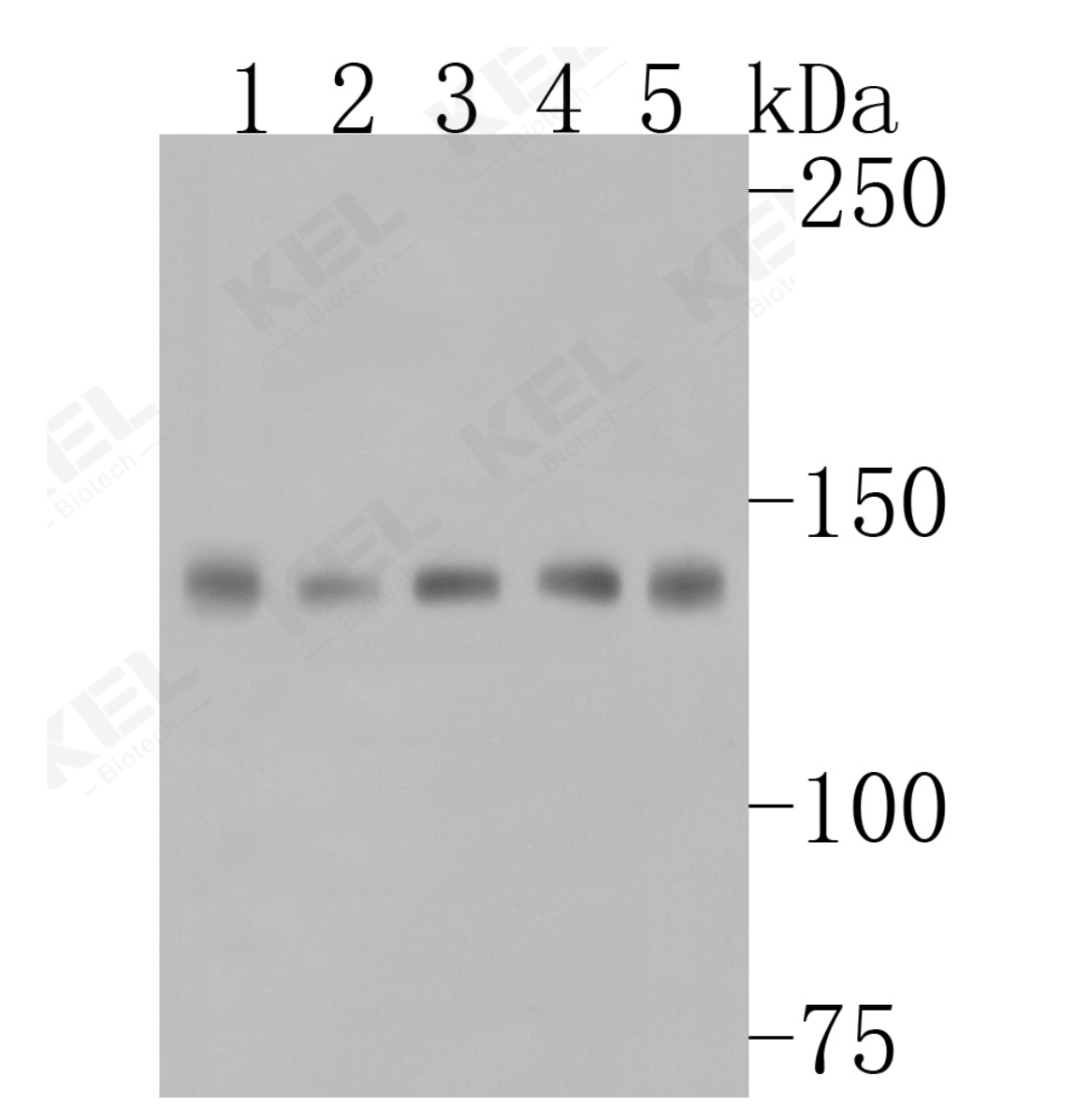 Met (c-Met) Rabbit Polyclonal Antibody