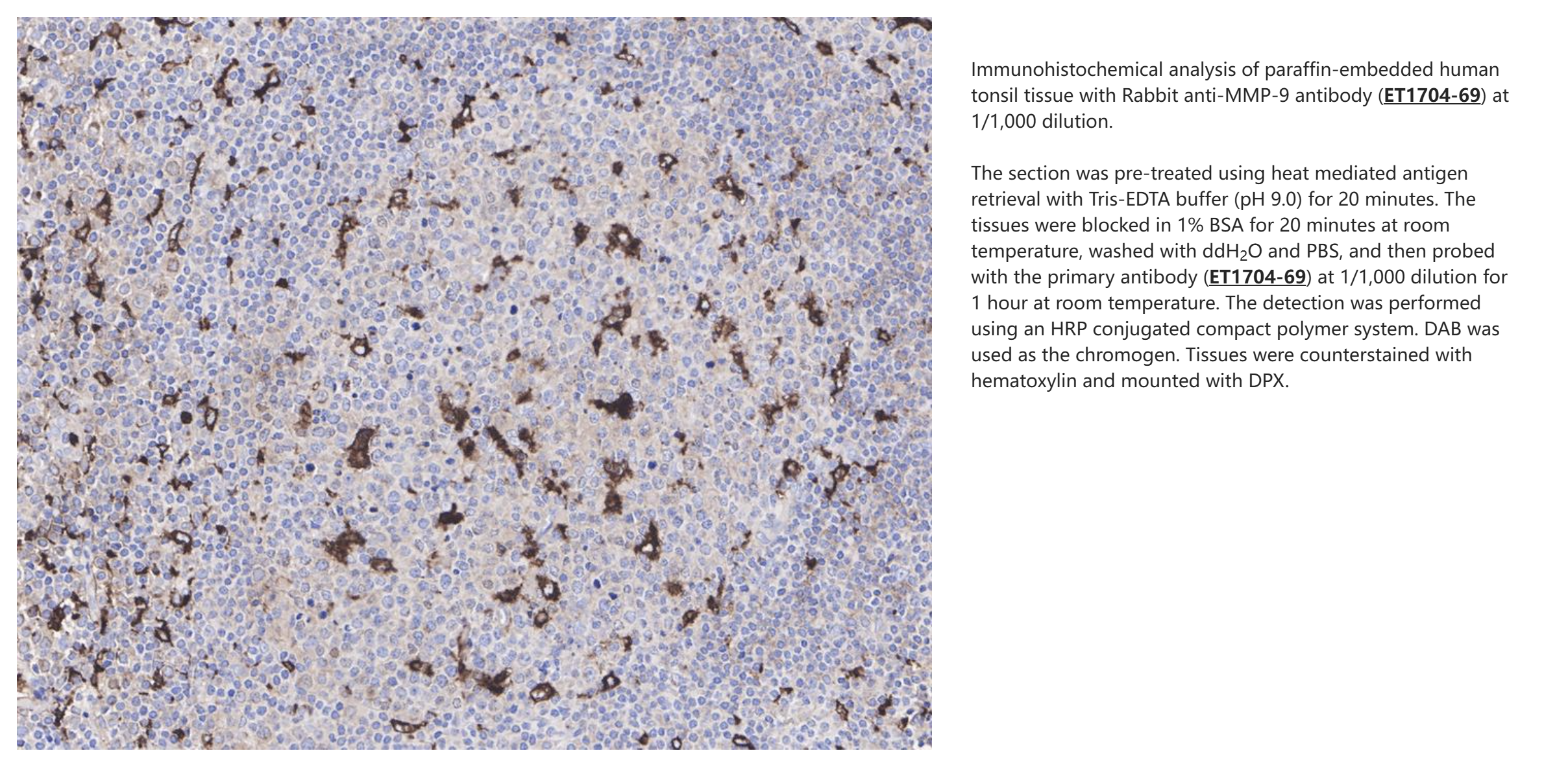 Anti-MMP-9 Antibody [JA80-73] KET1704-69