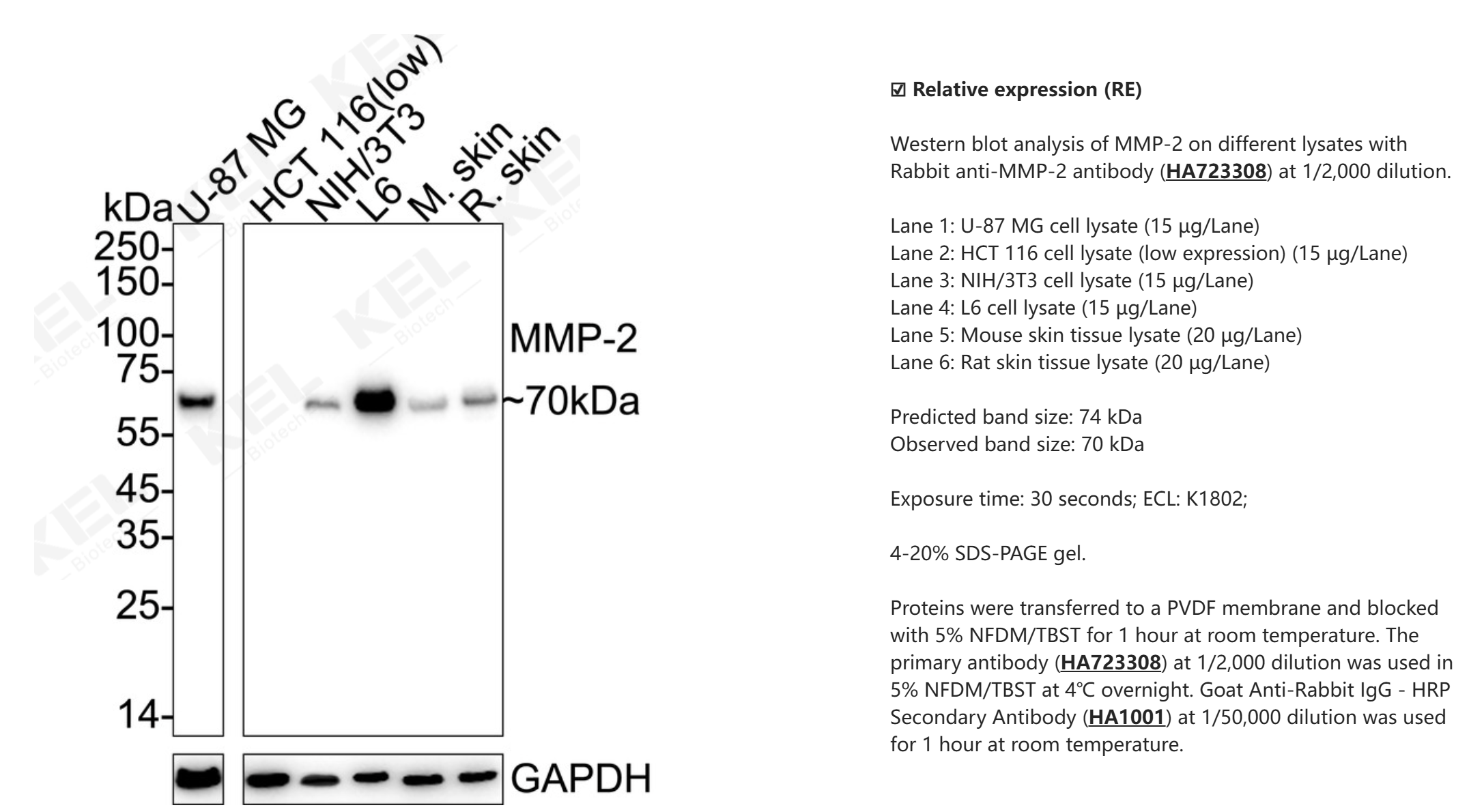 MMP-2 Recombinant Rabbit Monoclonal Antibody [PSH11-26]
