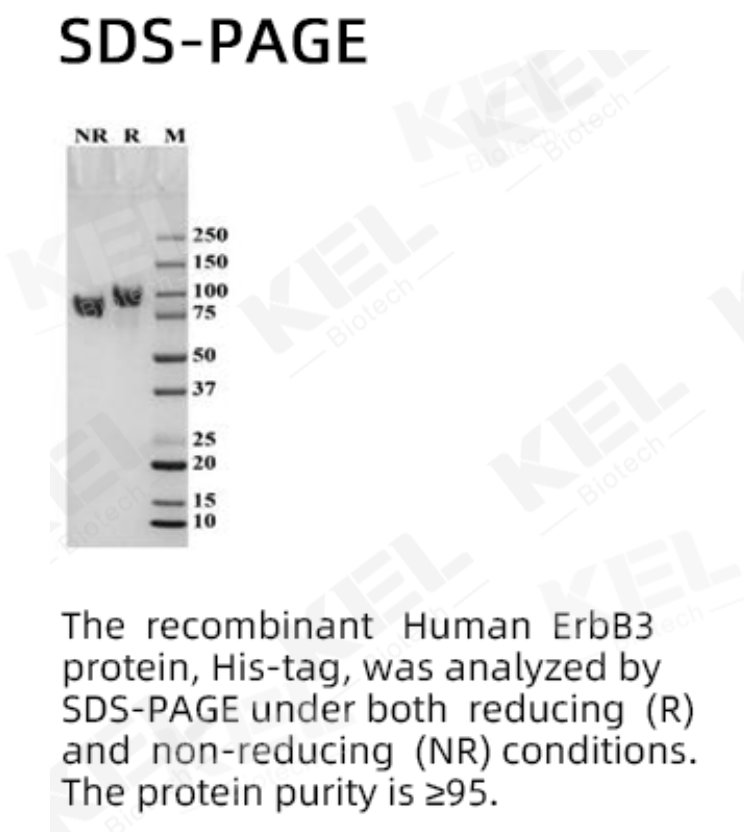 Recombinant Human ErbB3 (HER3) Protein (His Tag)